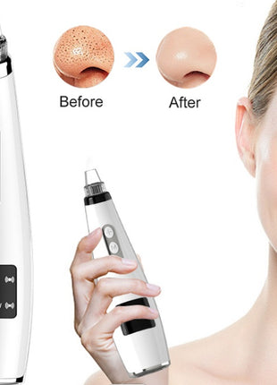 Electric Black Head Face Cleaner