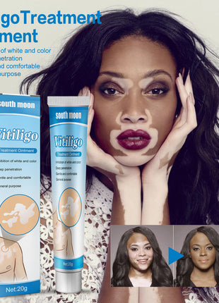 South Moon Skin Spot Removal Cream