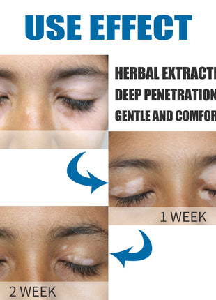 South Moon Skin Spot Removal Cream