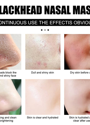 Nasal Pore Cleansing with 60 pcs Sheets