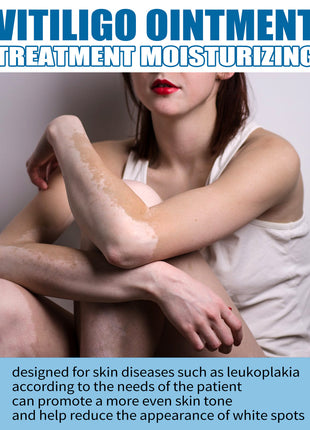 South Moon Skin Spot Removal Cream