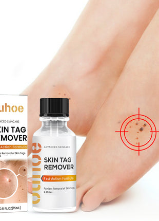 OUHOE Skin Wart Remover