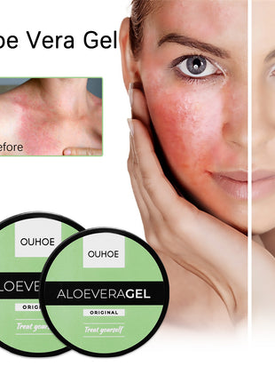 OUHOE Aloe Vera Gel