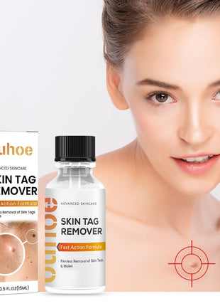 OUHOE Skin Wart Remover