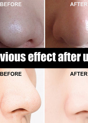 Nasal Pore Cleansing with 60 pcs Sheets