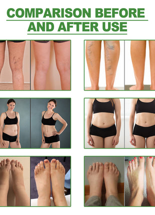 Before and after use comparison of a skin care product on legs, abdomen, and feet.