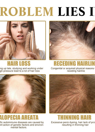 OUHOE Ginseng Scalp Hair Care