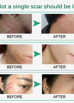 Before and after comparison of skin treatment results with green accents.