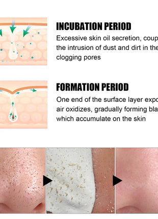 Nasal Pore Cleansing with 60 pcs Sheets