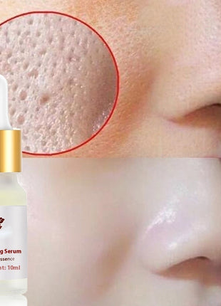 Pore refining serum bottle with close-up of skin showing pores before and after treatment.