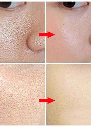 Before and after comparison of skin texture with a red arrow pointing to the difference.