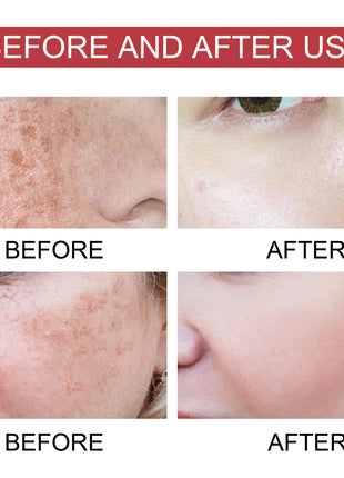 Before and after use comparison of skin treatment on a person's face.