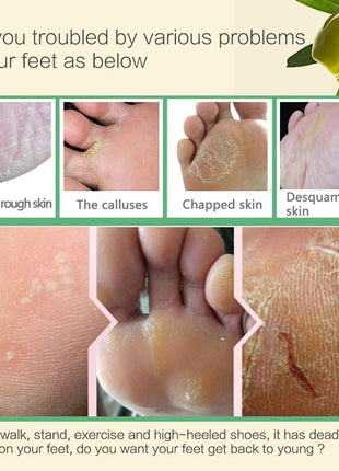 Foot care product advertisement showing foot issues and a plant.