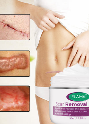 Scar removal cream with before-and-after images of scars on a person's leg.
