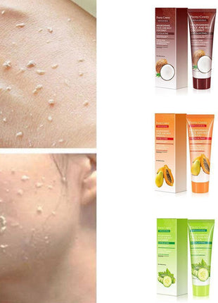Skincare product packaging with a close-up of skin with blemishes.