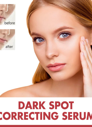 Advertisement for dark spot correcting serum showing a woman's face with before and after effects.