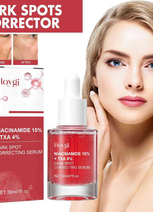 Hoygi Niacinamide 10% + TXA 4% Dark Spot Correcting Serum with packaging and a model showing results.