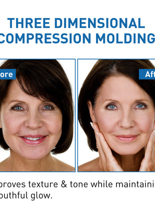 Before and after comparison of facial treatment with text about three-dimensional compression molding.