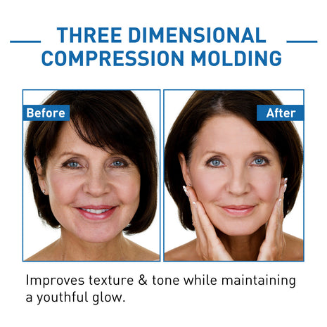 Before and after comparison of facial treatment with text about three-dimensional compression molding.