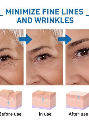 Before and after effect of a skincare product on skin with fine lines and wrinkles.