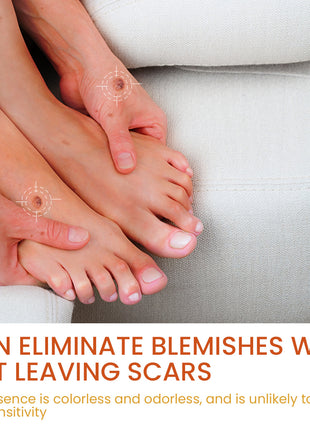 OUHOE Skin Wart Remover