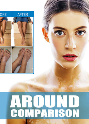 South Moon Skin Spot Removal Cream