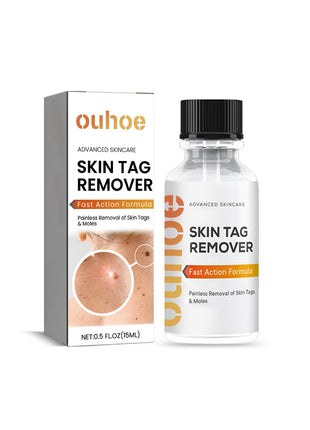 OUHOE Skin Wart Remover