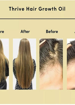 Thrive Rosemary Hair Care Oil