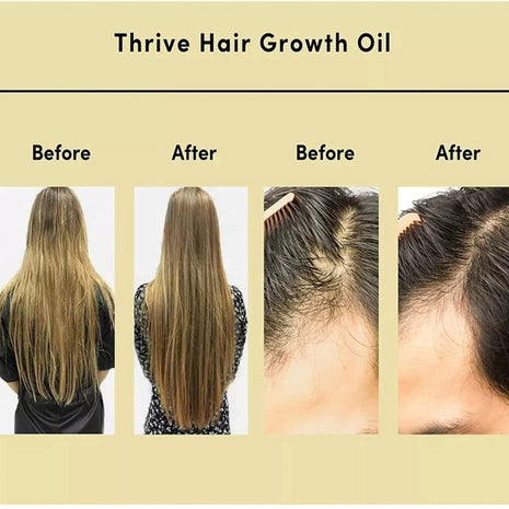 Thrive Rosemary Hair Care Oil