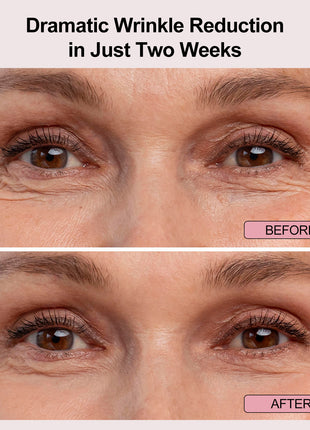 Light Eye Mask Four-color LED technology