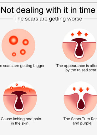 Illustration showing the progression of scars on skin with text indicating worsening and complications.